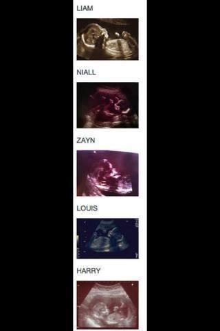 1d_embrio.jpg